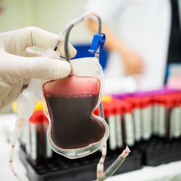 FIRST TEST OF LAB-GROWN HUMAN BLOOD