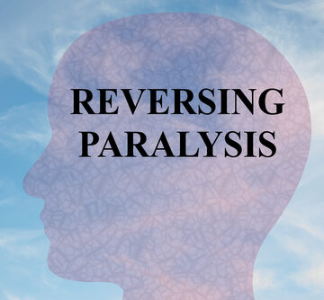 Render,Illustration,Of,"reversing,Paralysis",Title,On,Head,Silhouette,,With PARALYZED MAN WALKS WITH ELECTRONIC BRAIN-SPINE BRIDGE