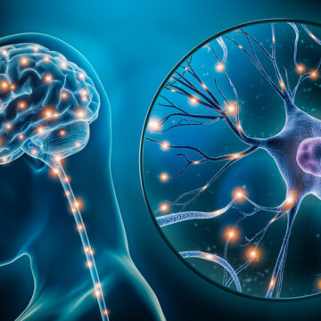 IT’S NOT A BRAIN TRANSPLANT, BUT…