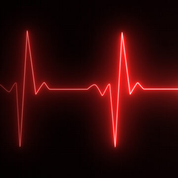 EEG Showing Pulse Rate
