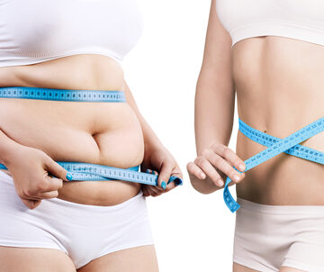 Woman's,Body,Before,And,After,Weight,Loss. A Woman's Body Before And After Weight Loss