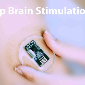 TINY IMPLANT UNDER THE SKIN STIMULATES BRAIN IMPROVEMENTS