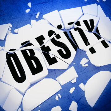 Shattered Obesity Sign
