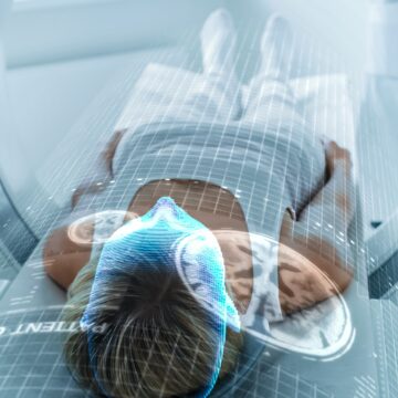 AN AI READS MRI BRAIN SCANS AND FLAGS EMERGENCIES IN SECONDS