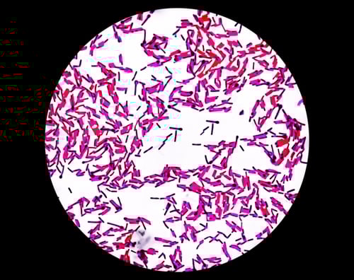 HUMAN-MADE BACTERIA EATS CANCER TUMORS FROM THE INSIDE OUT