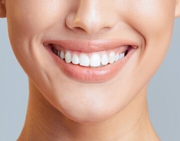 A close-up of a smiling woman, showcasing healthy and bright white teeth.