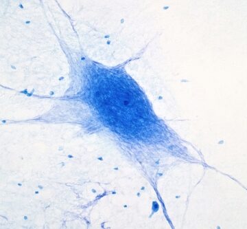 A light micrograph of a multipolar neuron, which are the primary structural and functional units of the central nervous system, including the brain and spinal cord.
