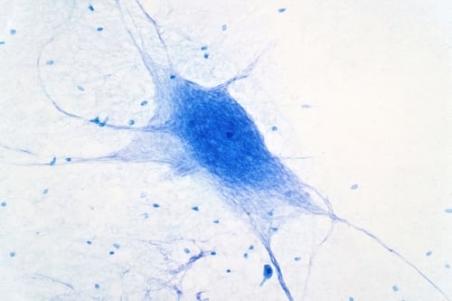 A light micrograph of a multipolar neuron, which are the primary structural and functional units of the central nervous system, including the brain and spinal cord.