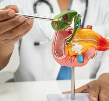 Pancreatitis,,Pancreatic,Cancer,,Asian,Doctor,With,Pancreas,,Gallbladder,And,Bile A medical professional displays an anatomical model of the pancreas and gallbladder, likely used for educational purposes.