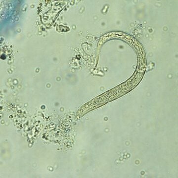 A microscopic view of a small, elongated, curved nematode larva, resembling a rhabditiform or first-stage hookworm or Strongyloides larva against a light background with cellular debris.