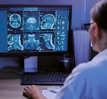 Caucasian,Middle,Aged,Woman,Analyzing,Brain,And,Spinal,Mri,Scans RESEARCHERS FIND THE BRAIN’S TRIGGER FOR DISEASES OF AGING