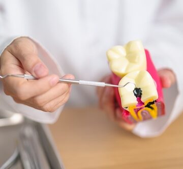 THE ROLE OF VITAMIN K IN TOOTH DECAY