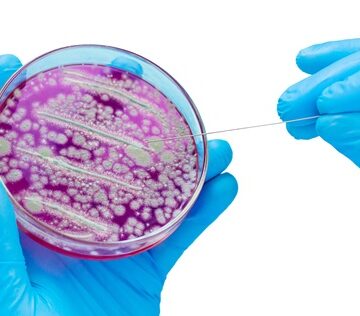 Examine,Bacteria,In,Petri,Dishes,In,The,Laboratory.,Selective,Focus. COULD A MAGNETIC BACTERIUM EXTEND LIFE?