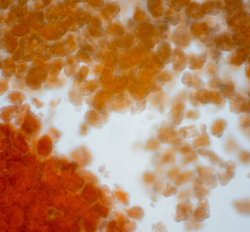 The image shows adipose tissue (fat cells) under a microscope, featuring large lipid droplets.